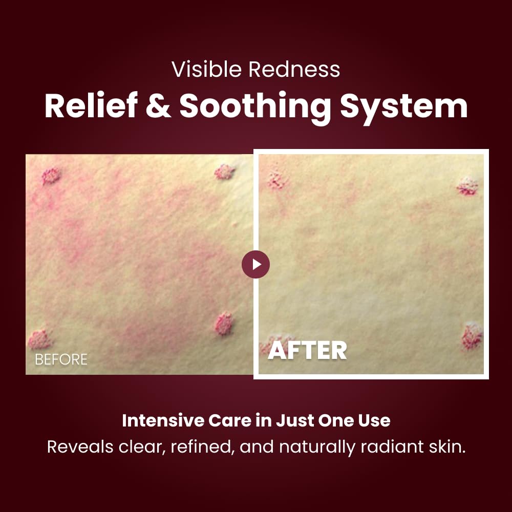 KOPHER Curepair Melder SOS Crema, aplicación nocturna que favorece la reparación durante la rutina.