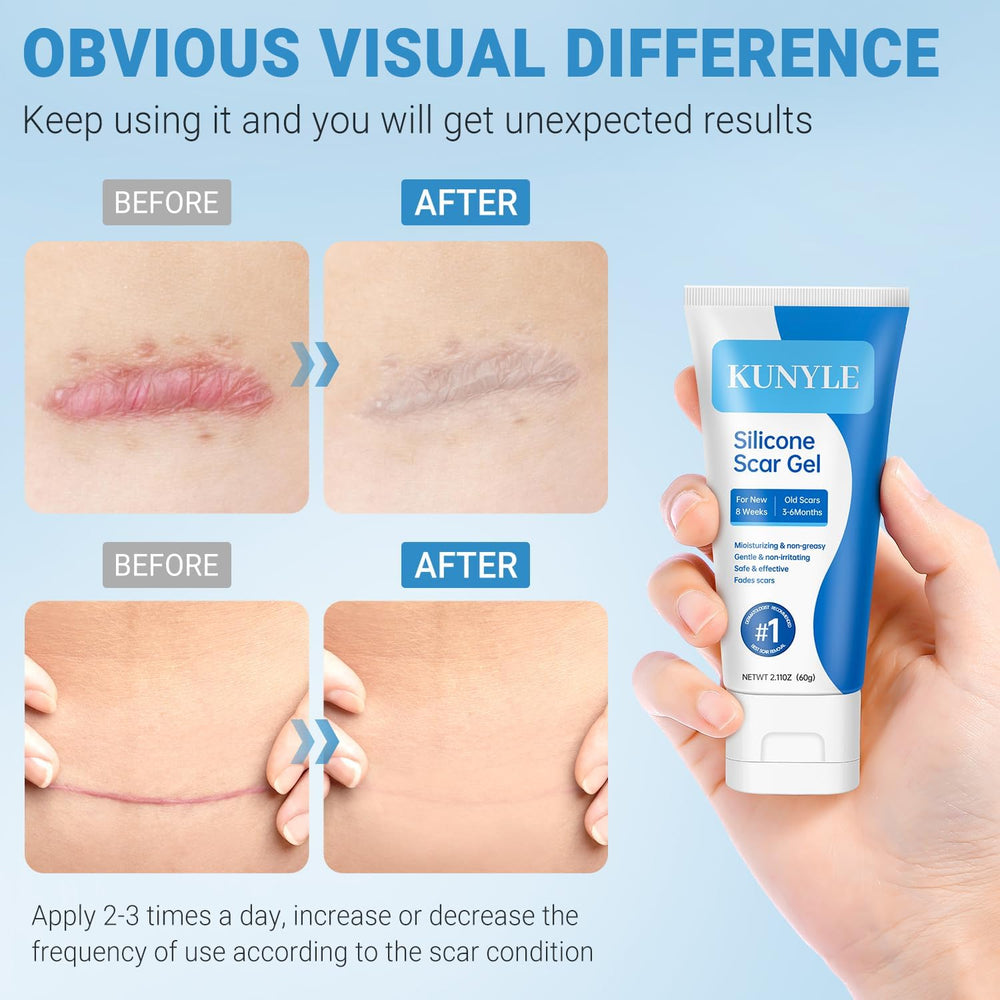 Kunyle Gel de Silicona: hidratación profunda para piel suave y nutrida.