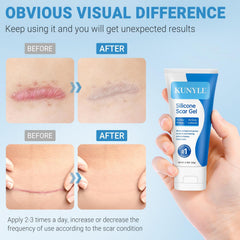 Kunyle Gel de Silicona: hidratación profunda para piel suave y nutrida.