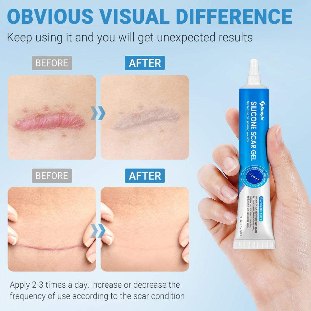 Kunyle textura gel silicona: textura ligera que hidrata sin grasa.