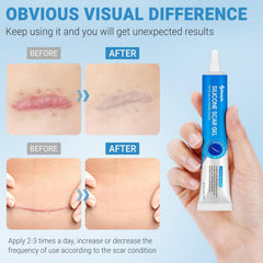 Kunyle textura gel silicona: textura ligera que hidrata sin grasa.