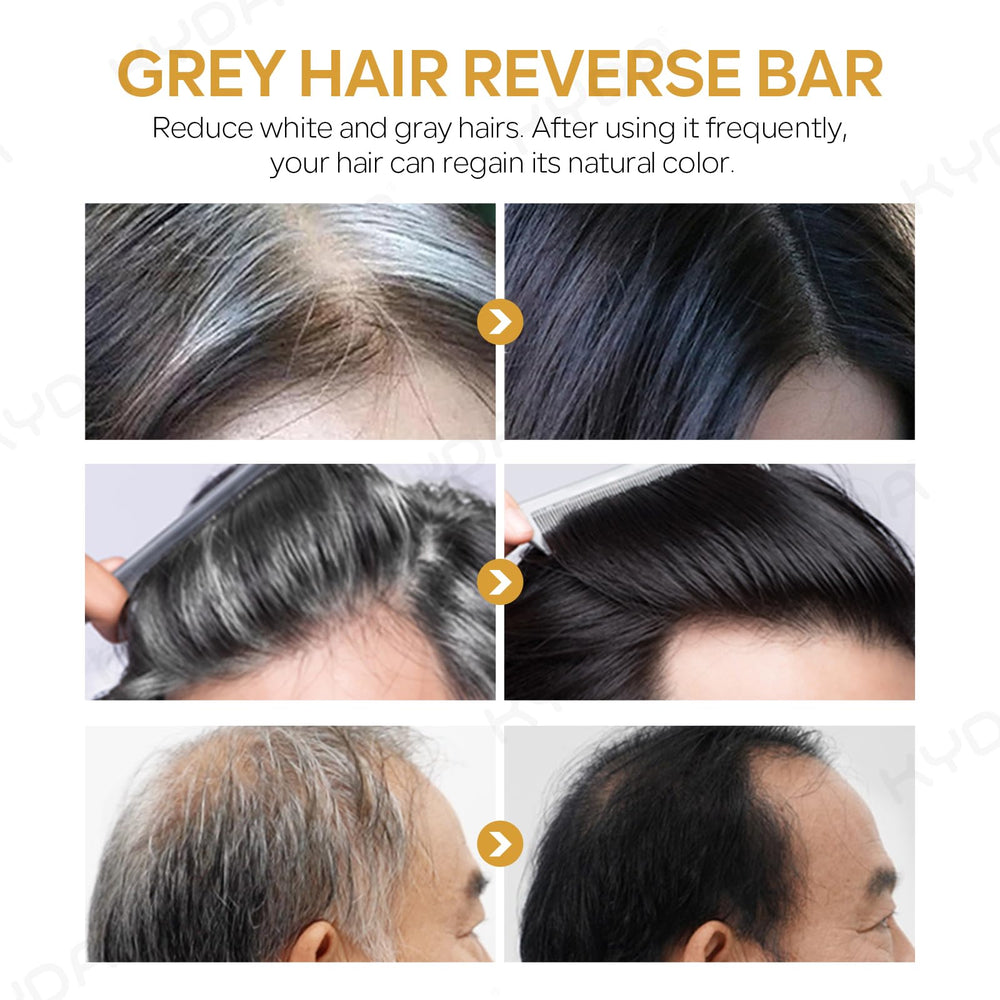 KYDA barra champú nutrición cuero cabelludo para cabello saludable