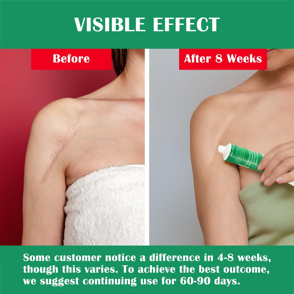 Ladygo Advance: uso en cuerpo para cicatrices antiguas o nuevas.