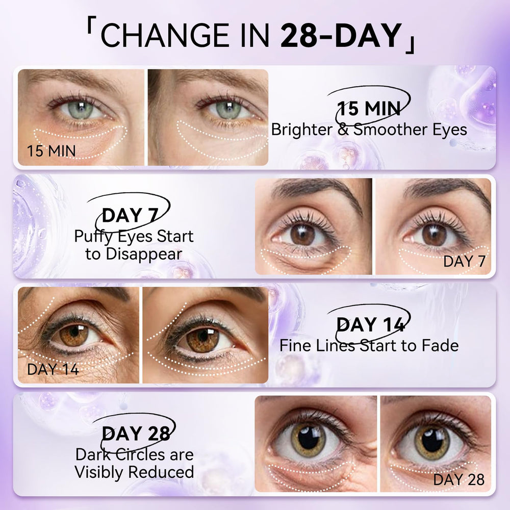 LANBENA Parches ojos retinol, textura hidrogel que ofrece frescura instantánea.