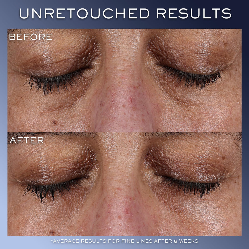 Lancôme Génifique Contorno de Ojos, reducción visual de arrugas suaves alrededor de los ojos.