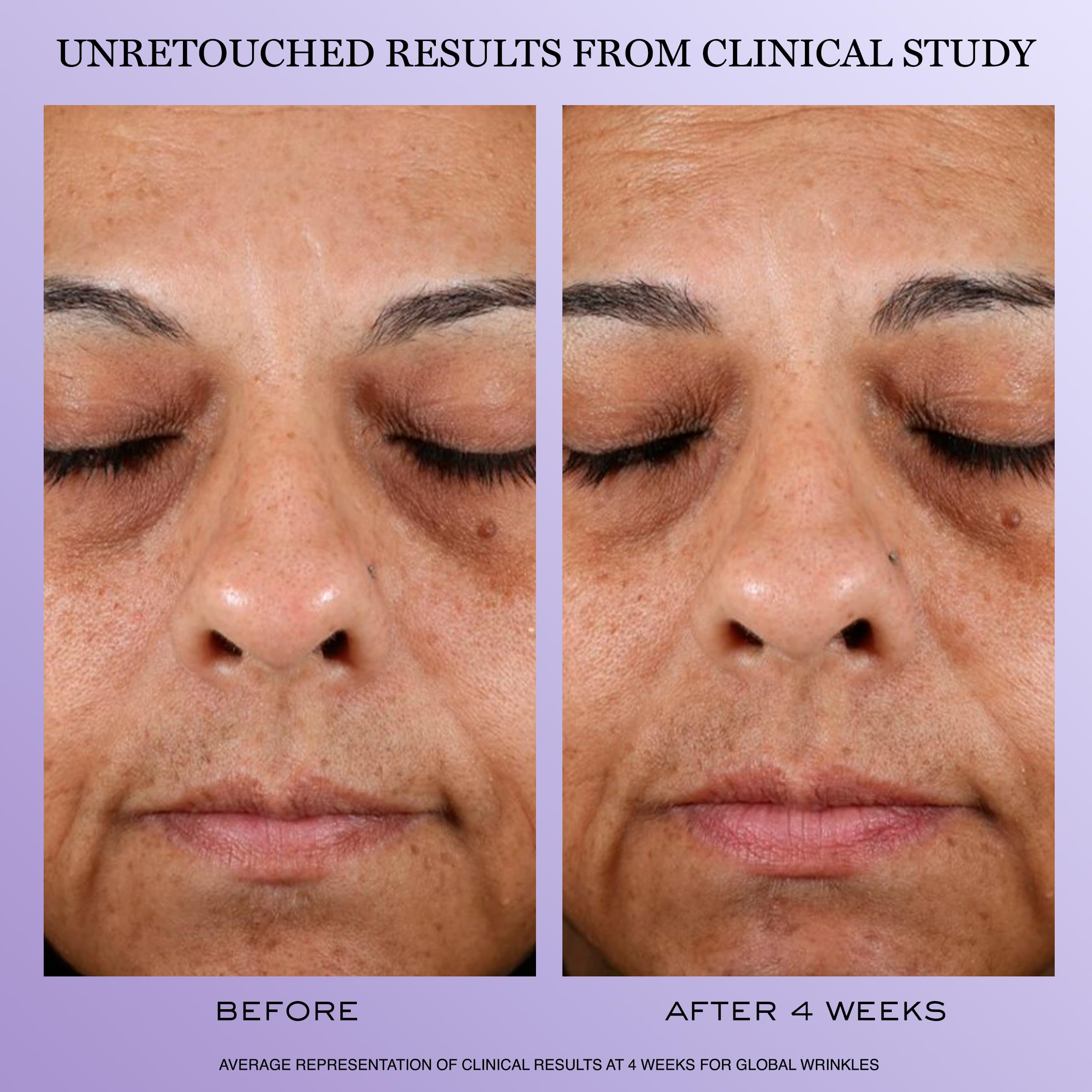 Ingrediente ácido hialurónico en Lancôme Rénergie H.P.N. 300-Peptide para hidratación profunda.