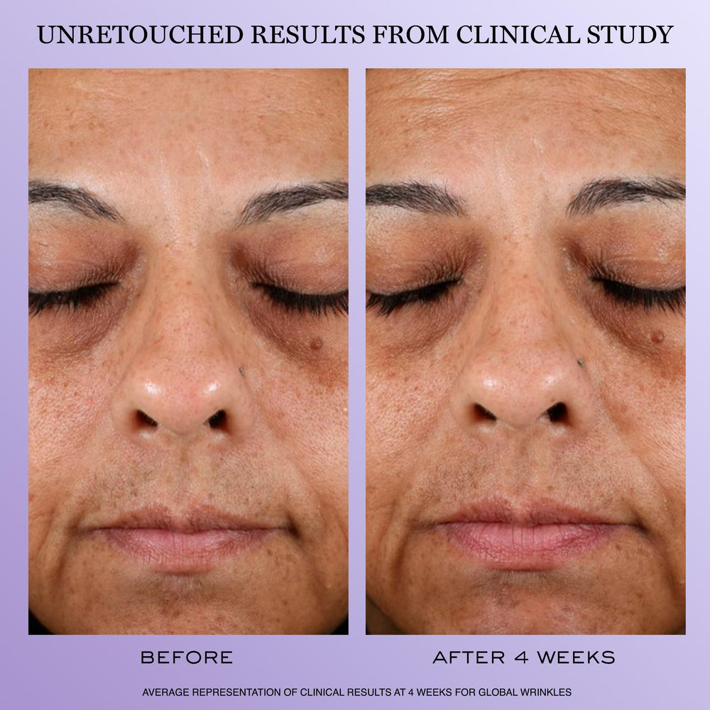 Ingrediente ácido hialurónico en Lancôme Rénergie H.P.N. 300-Peptide para hidratación profunda.