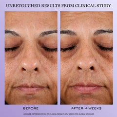 Ingrediente ácido hialurónico en Lancôme Rénergie H.P.N. 300-Peptide para hidratación profunda.