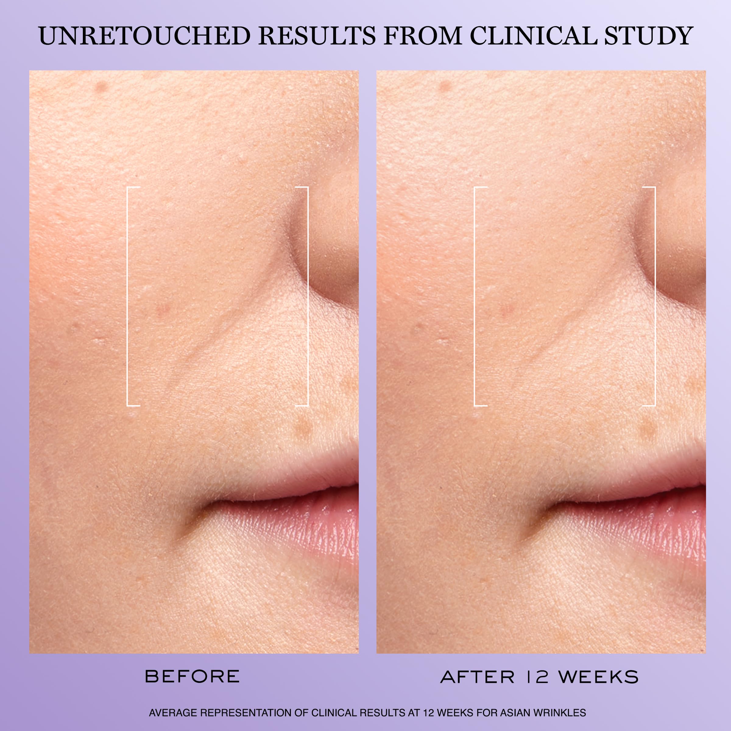 Lancôme Rénergie H.C.F. Triple Serum – texture légère et absorption rapide.