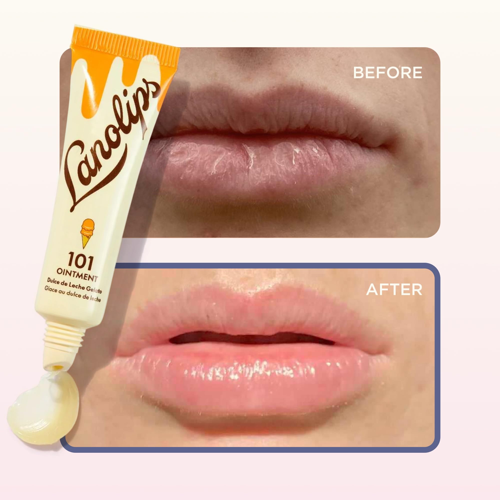 Lanolips 101 Ungüento para cutículas, ayuda a hidratar y suavizar.