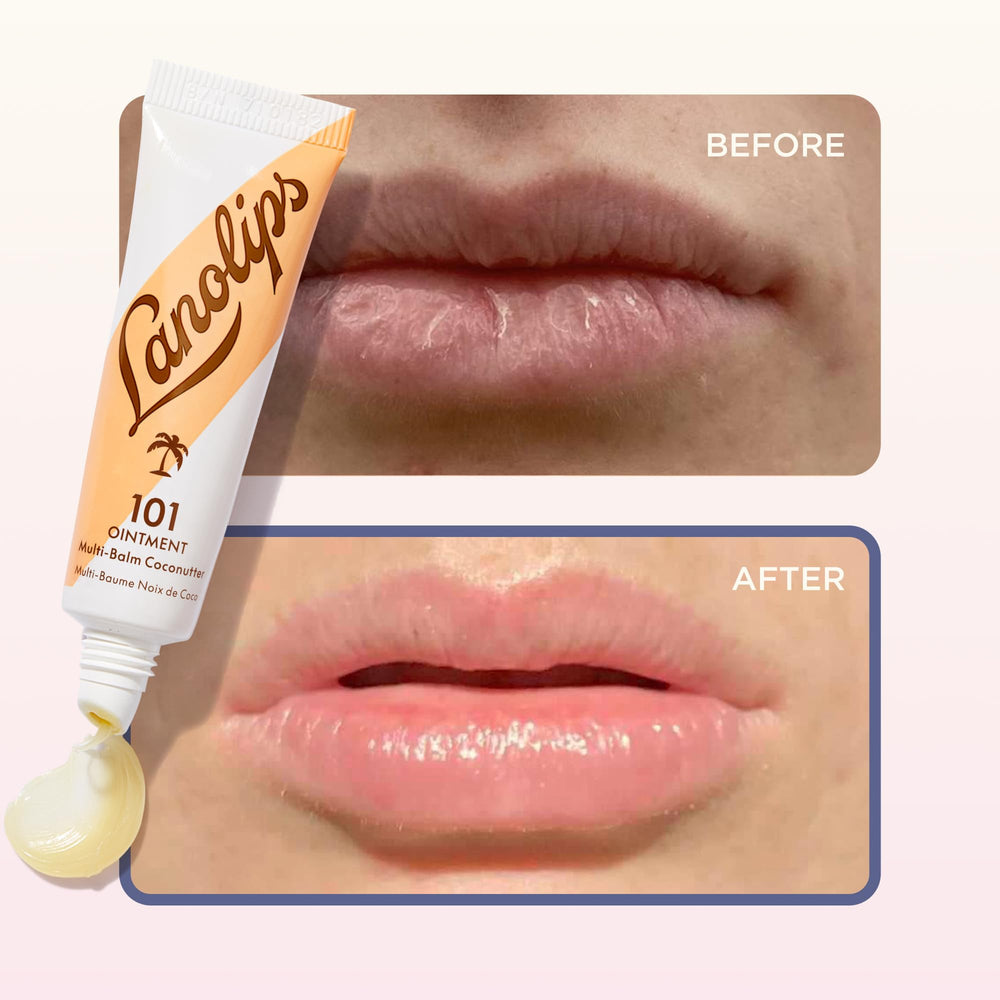 Lanolips 101 Ointment envase compacto para uso diario.