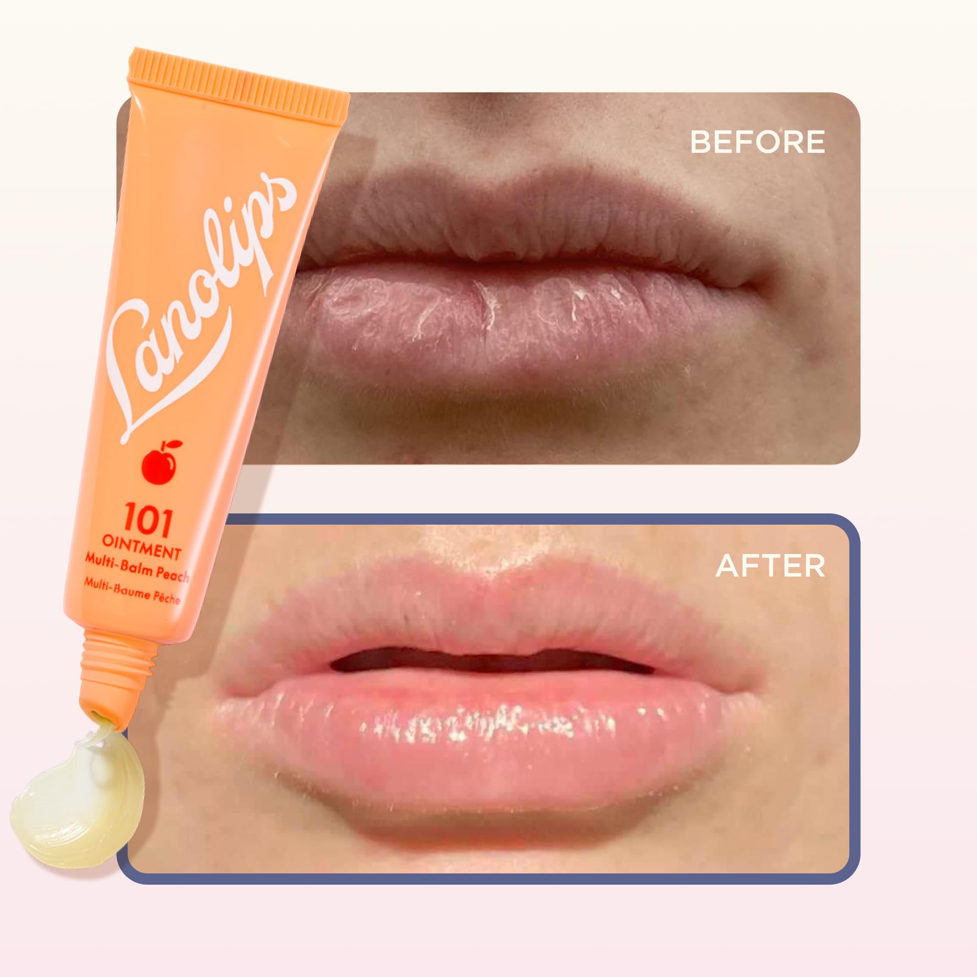 Lanolips 101 Ungüento, cuidado de cutículas secas con lanolina