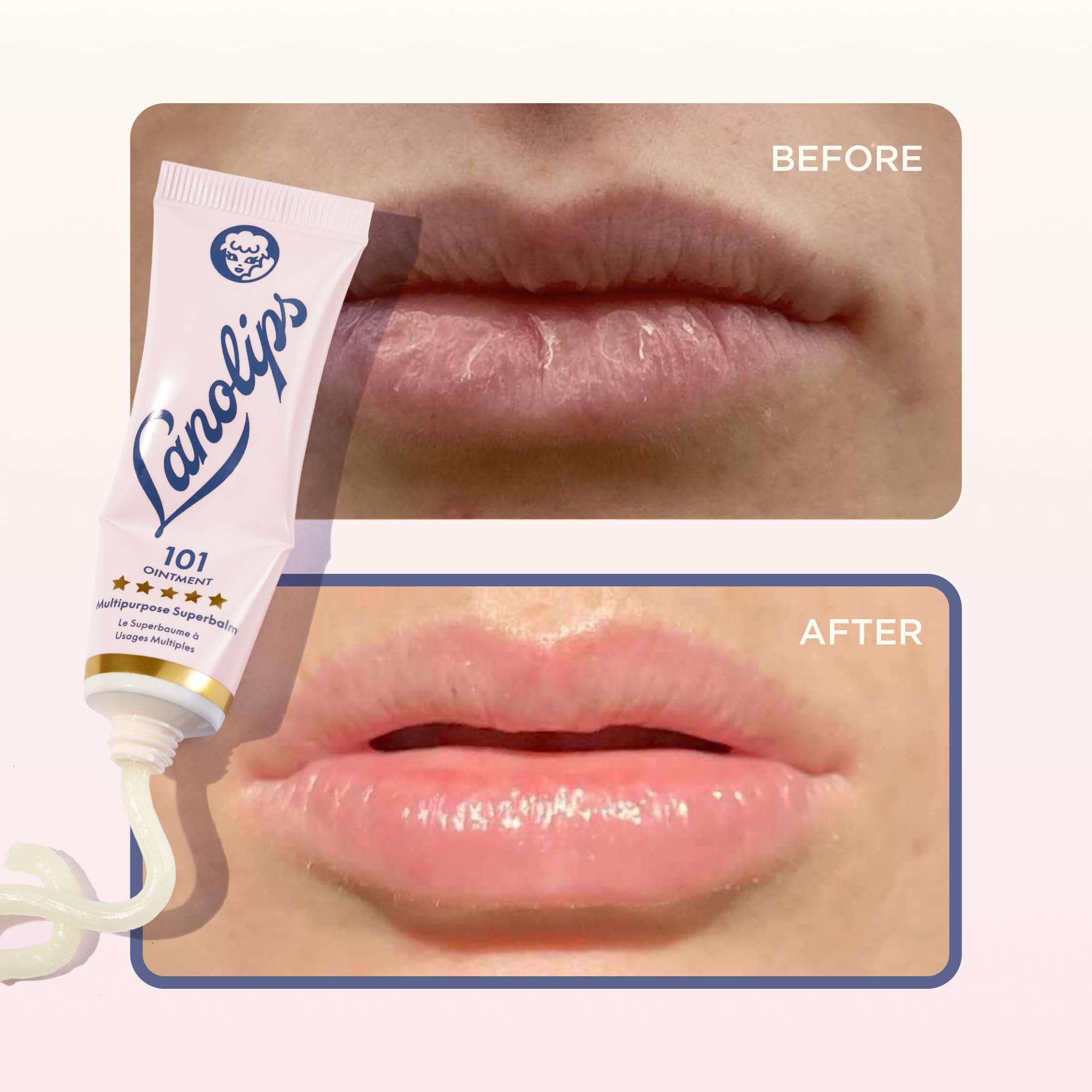 Lanolips 101 Ungüento para pezones durante la lactancia.