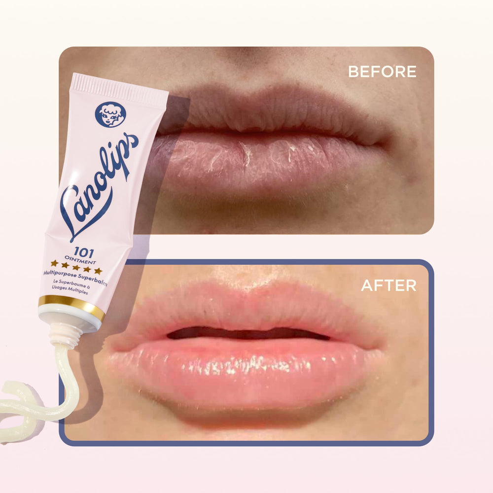Lanolips 101 Ungüento para pezones durante la lactancia.