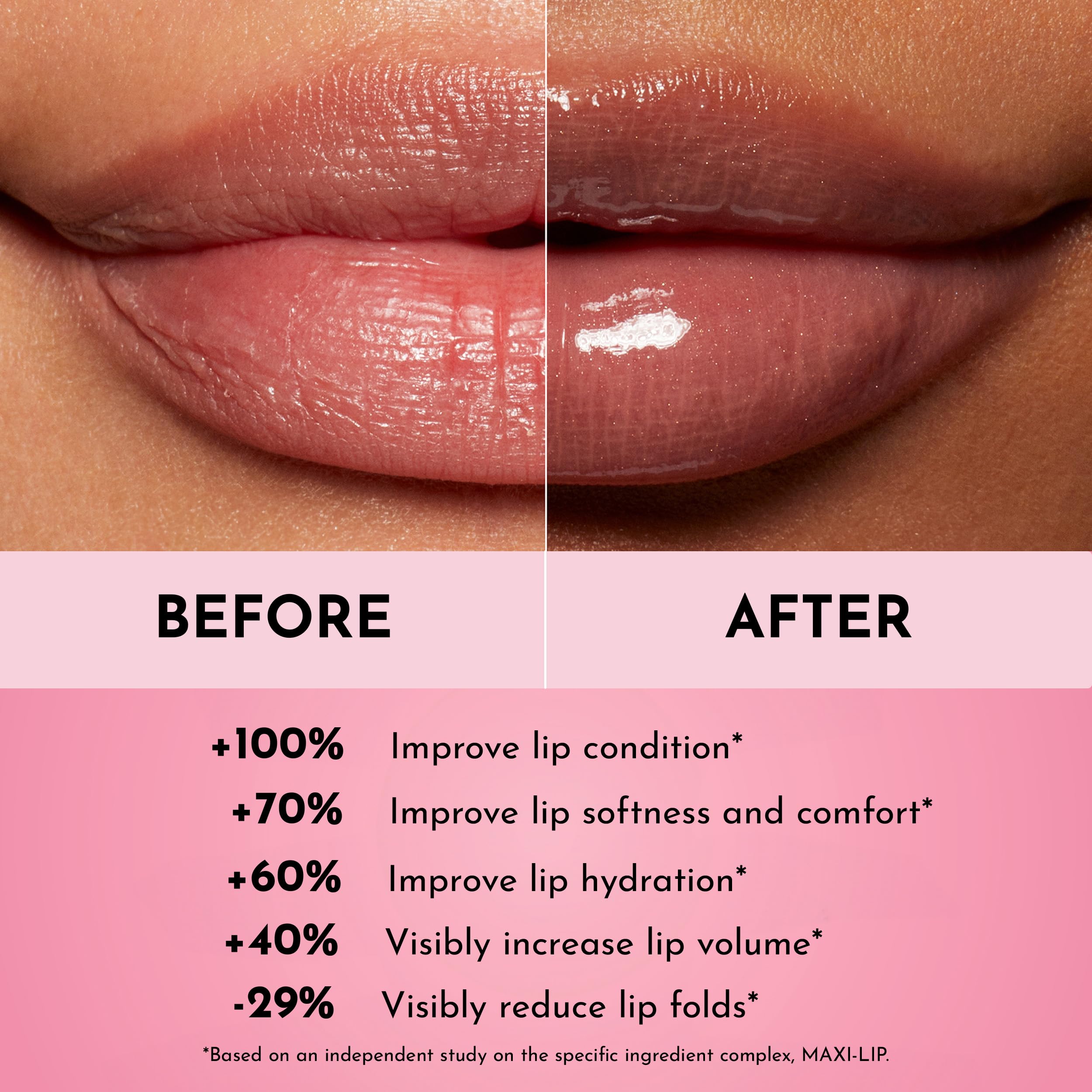 Lawless aumento de volumen labial, efecto suave y perceptible