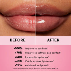 Lawless aumento de volumen labial, efecto suave y perceptible