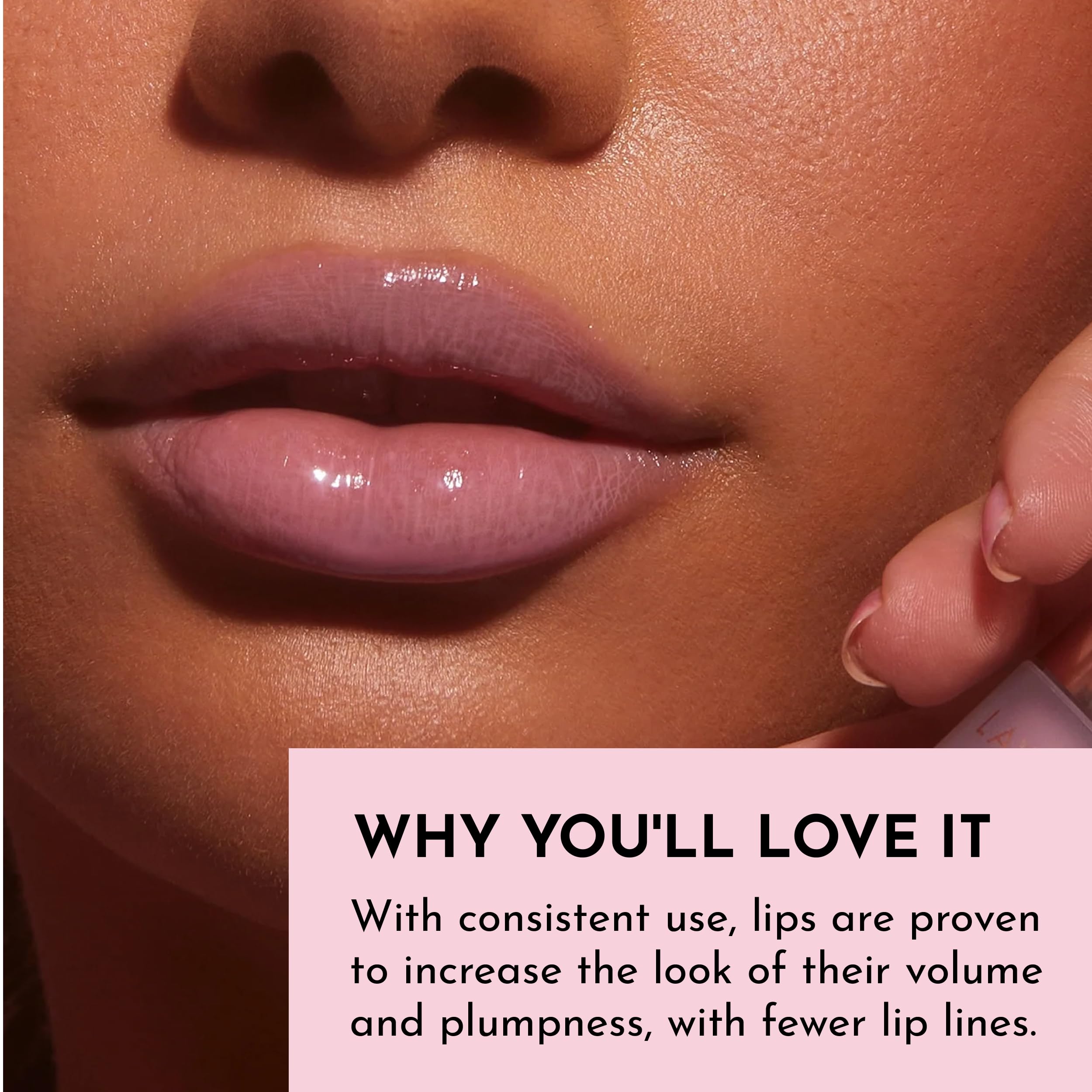 Resultados de volumen perceptible en labios con Lawless Forget The Filler.
