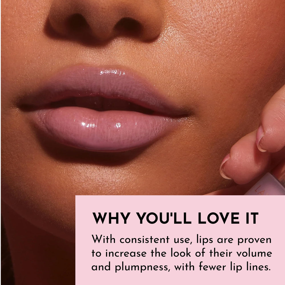 Resultados de volumen perceptible en labios con Lawless Forget The Filler.