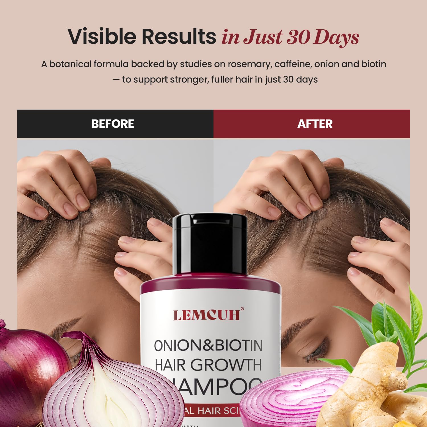 Lemcuh Champú para uso diario: cabello más nutrido y manejable.