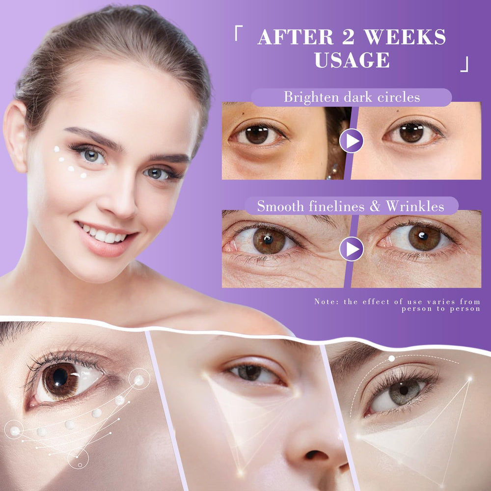 Lenaale contorno de ojos con retinol para posibles mejoras en la textura.