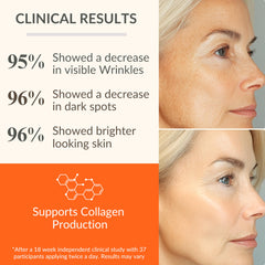 LeVaye' Serum Vitamina C: aplicación en mano para absorción rápida.