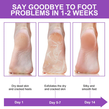 Liefiet lavender foot mask packaging shows product details and ingredients.
