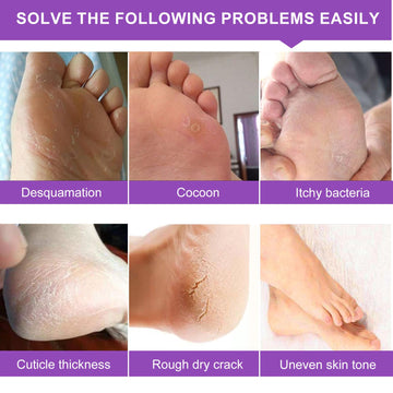 Liefiet mask addressing dry heels with hydrating, non-irritating formula.