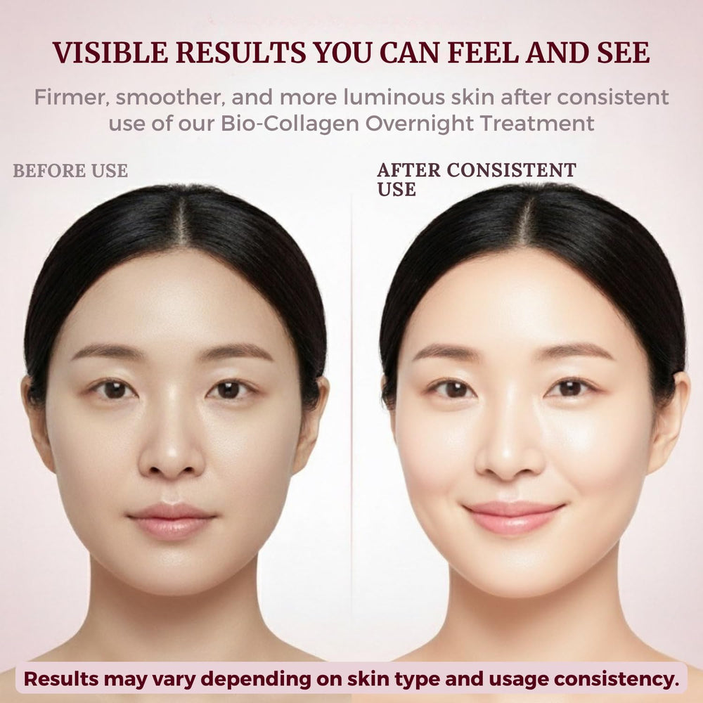 Liftouch conjunto de cuidado facial en casa, uso semanal estilo salón.