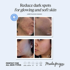Gotero de LilyAna Vitamina C Serum para una dosificación precisa y absorción rápida.