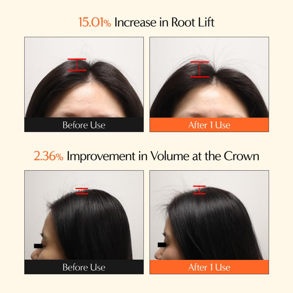 Lilyeve GrowTurn aplicación en cuero cabelludo para limpieza suave y absorción.