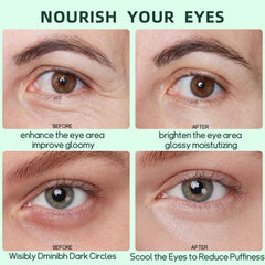 Lingyun parches ojos textura gel fresca despierta la mirada.