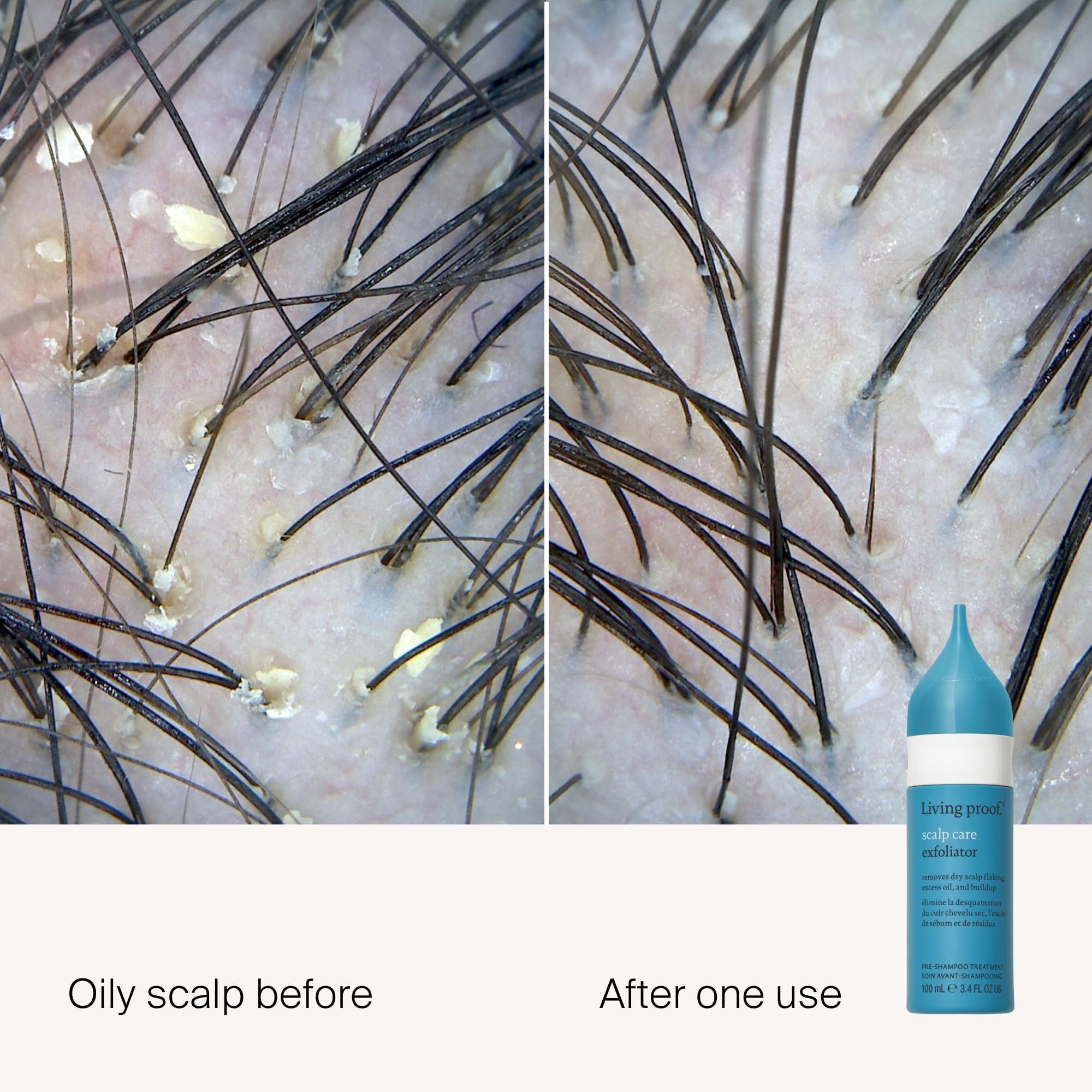 Living Proof exfoliante para cuero cabelludo con aplicador de punta para aplicación precisa