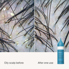 Living Proof exfoliante para cuero cabelludo con aplicador de punta para aplicación precisa