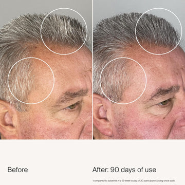 Aprobado por dermatólogos para cuidado diario del cuero cabelludo.