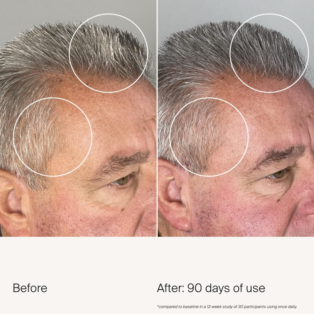Aprobado por dermatólogos para cuidado diario del cuero cabelludo.