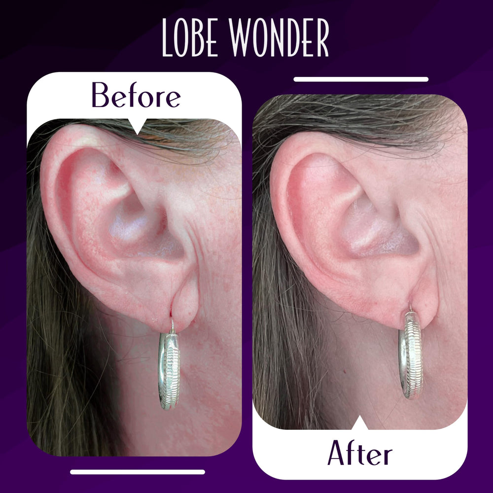 Lobe Wonder parche evita estiramiento del lóbulo, respaldo cómodo para cualquier arete.