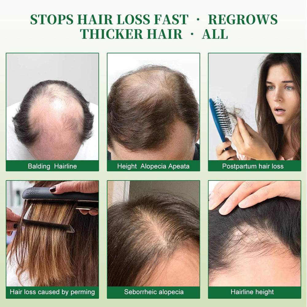 Lorrnyee Batana Oil Shampoo: acabado suave y brillo visible