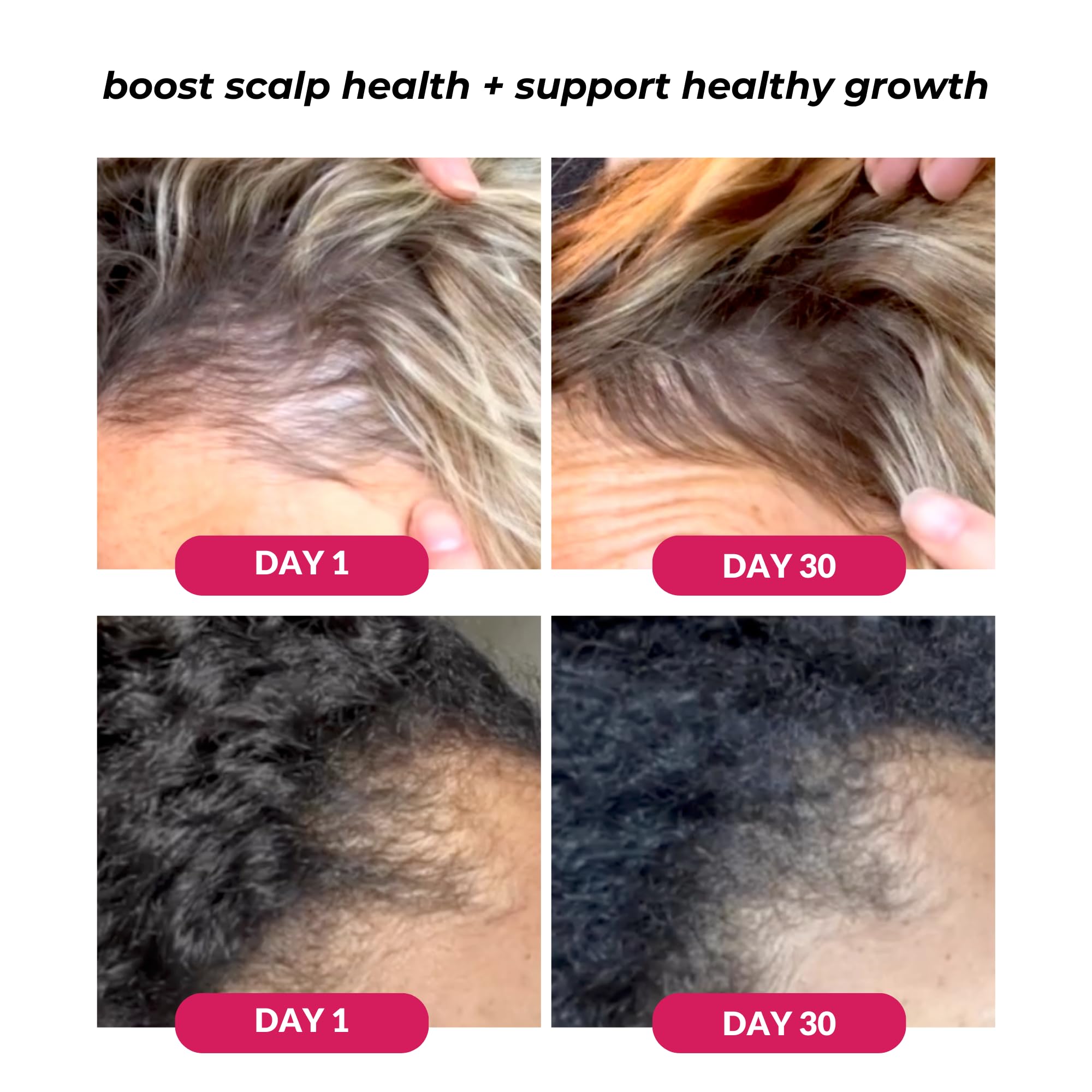 Love Ur Curls Serum favorece crecimiento capilar y densidad visible con uso regular.