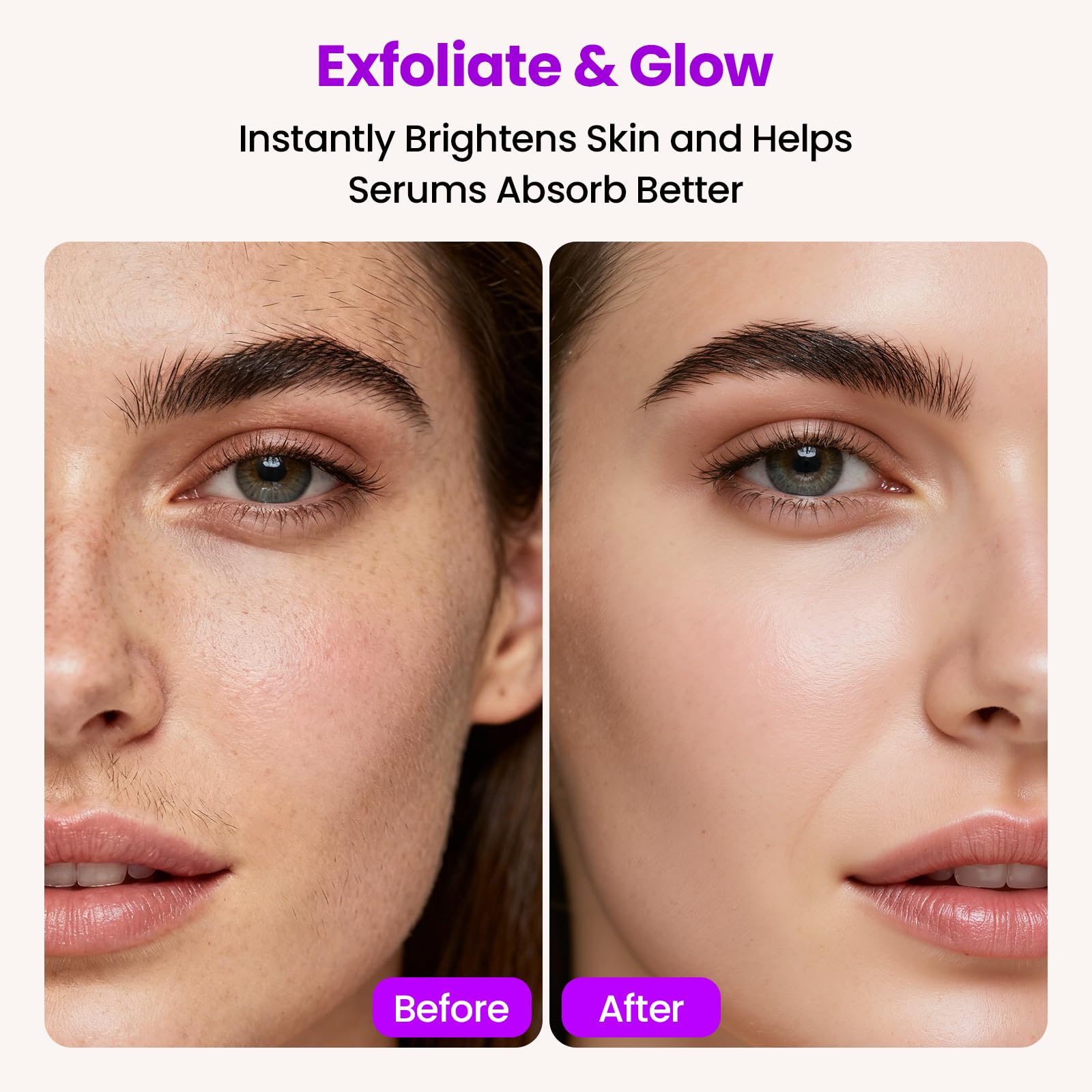 Lovsheme Afiladora Dermaplane Sonico 3 velocidades para precisión en diferentes zonas
