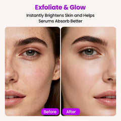 Lovsheme Afiladora Dermaplane Sonico 3 velocidades para precisión en diferentes zonas