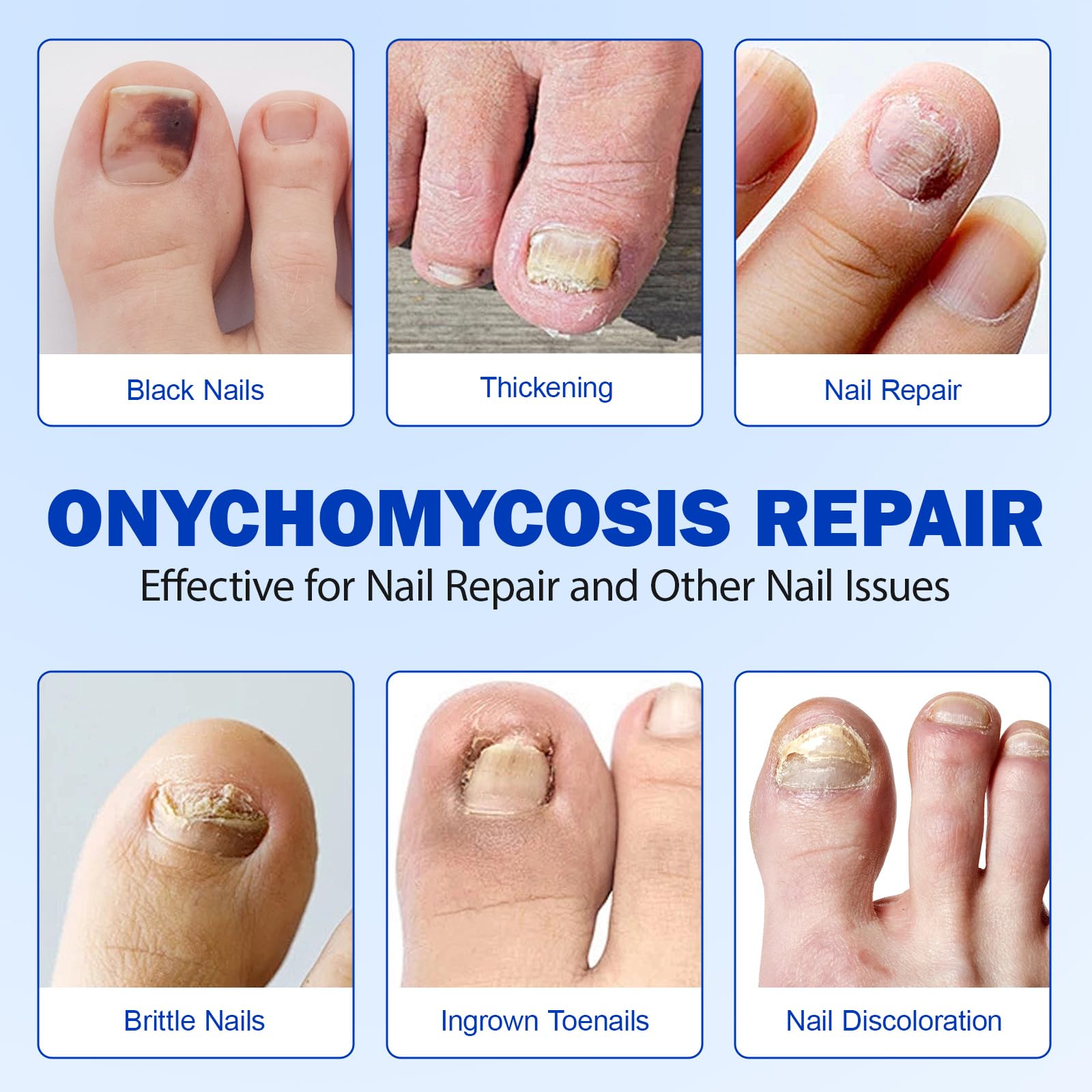 LTQXGT Nail Repair Glue provides professional-grade adhesion for durable at-home fixes