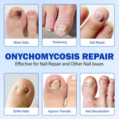LTQXGT Nail Repair Glue provides professional-grade adhesion for durable at-home fixes