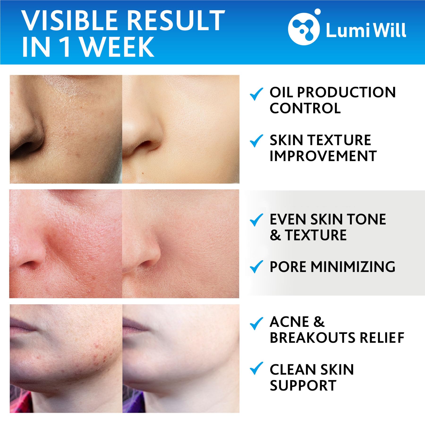 LUMI WILL aplicación diaria exfoliante facial para textura más suave.