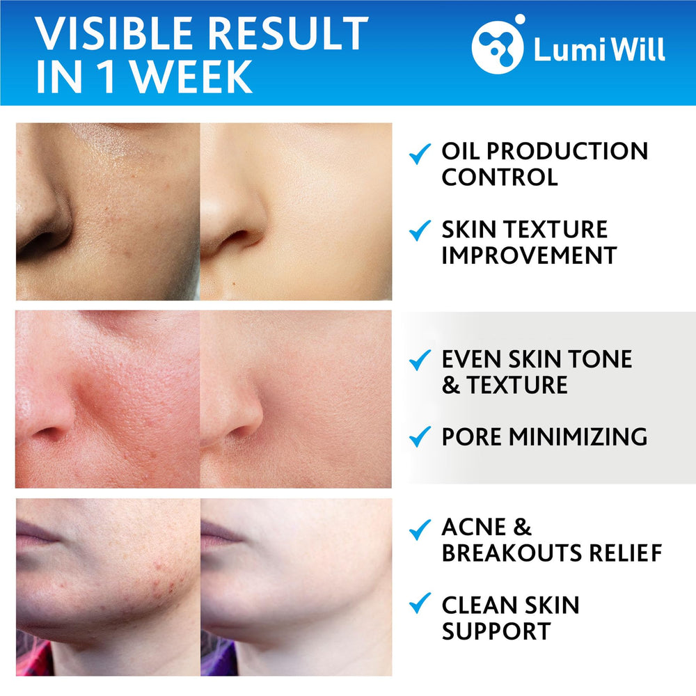 LUMI WILL aplicación diaria exfoliante facial para textura más suave.