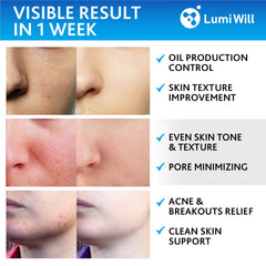 LUMI WILL aplicación diaria exfoliante facial para textura más suave.