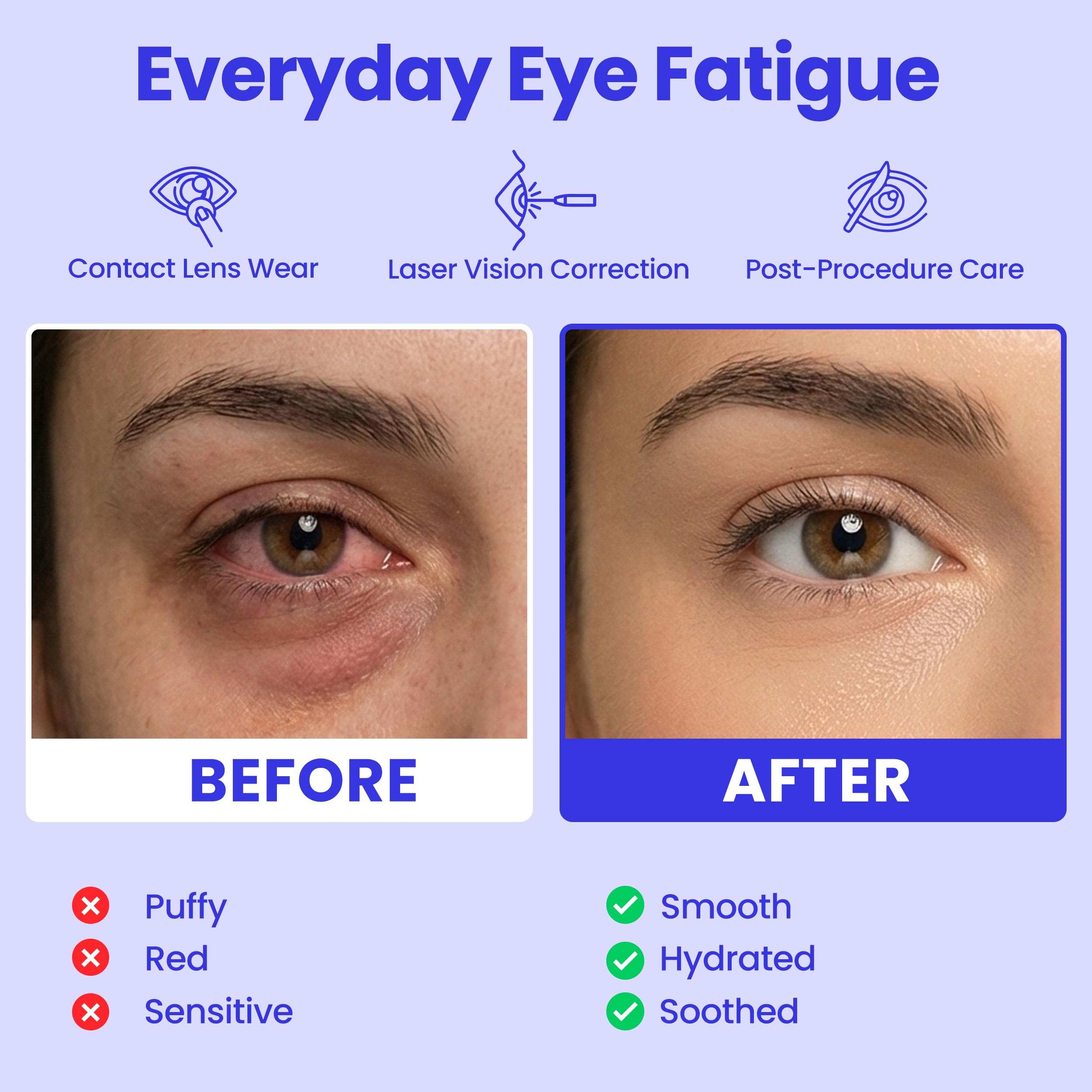 Utilisation en voyage du masque yeux vapeur Lure Essentials