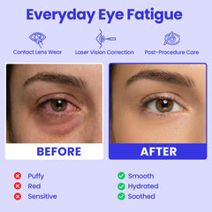 Utilisation en voyage du masque yeux vapeur Lure Essentials