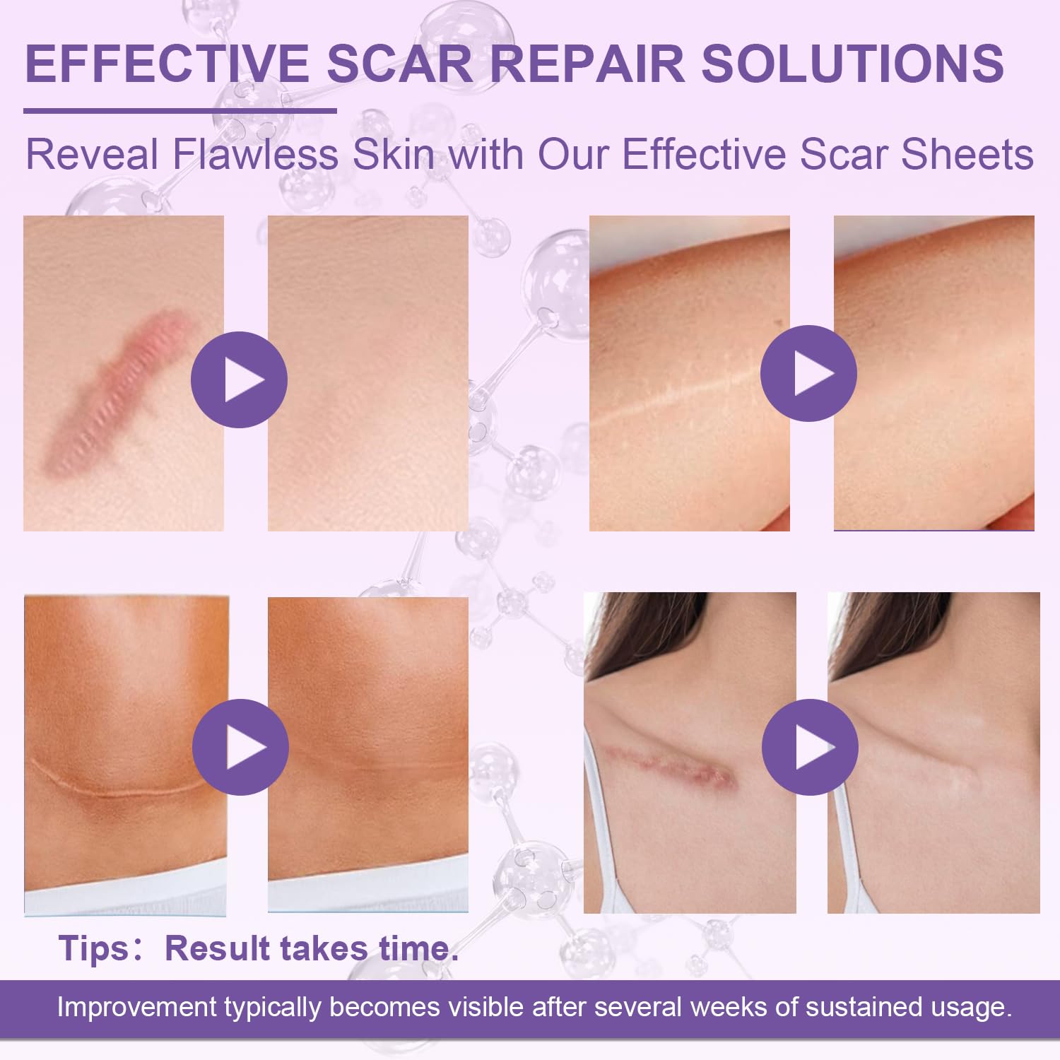 Luxefus parche de silicona para cicatriz facial, protege la piel delicada.