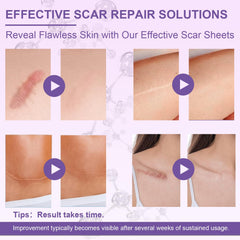 Luxefus parche de silicona para cicatriz facial, protege la piel delicada.