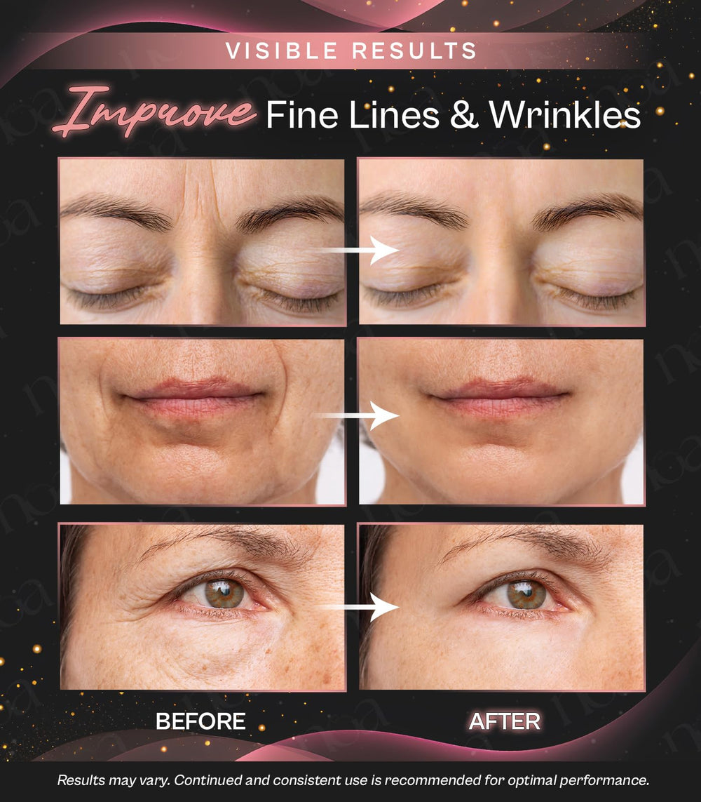LuxeSkin modelage du visage et du cou pour soutenir l'élasticité.